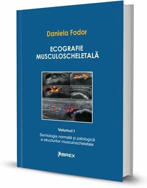 Ecografie musculoscheletală - Daniela Fodor - Vol. I