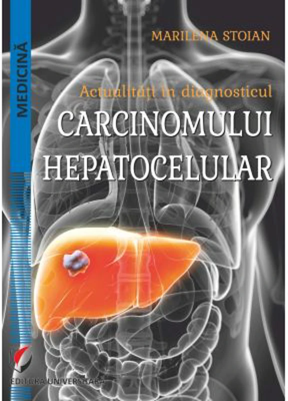 Actualitati in diagnosticul carcinomului hepatocelular - Marilena Stoian