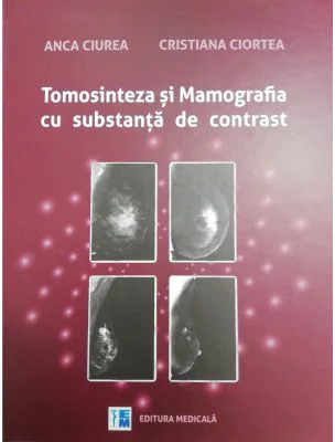 Tomosinteza si Mamografia cu substanta de contrast - Anca Ciurea, Cristiana Ciortea