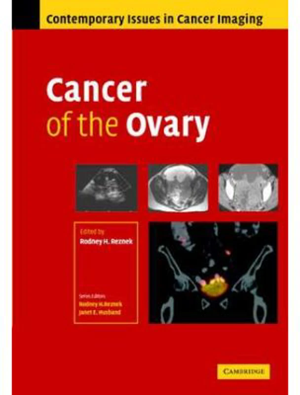 Cancer of the Ovary - Rodney Reznek