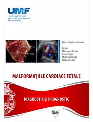 Malformatii cardiace fetale - Claudiu Marginean