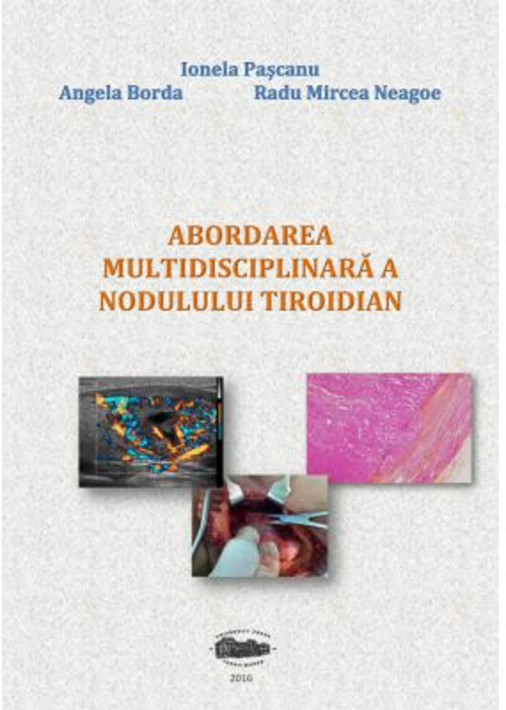 Abordarea multidisciplinara a nodulului tiroidian - Ionela Pascanu