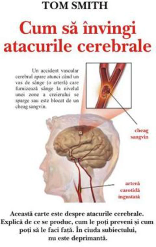 Cum sa invingi atacurile cerebrale – Tom Smith