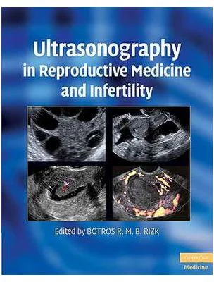 Ultrasonography in Reproductive Medicine and Infertility - Botros R. M. B. Rizk