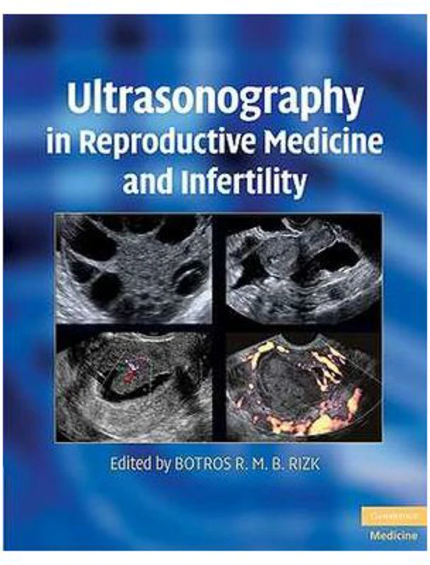 Ultrasonography in Reproductive Medicine and Infertility - Botros R. M. B. Rizk