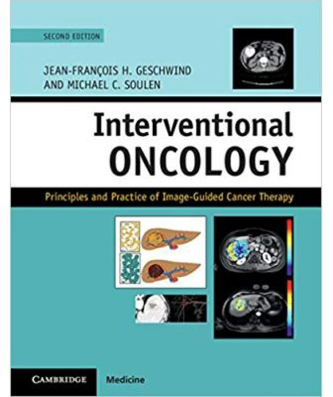 Interventional Oncology: Principles and Practice of Image-Guided Cancer Therapy - Jean-Francois H. Geschwind, Michael C. Soulen
