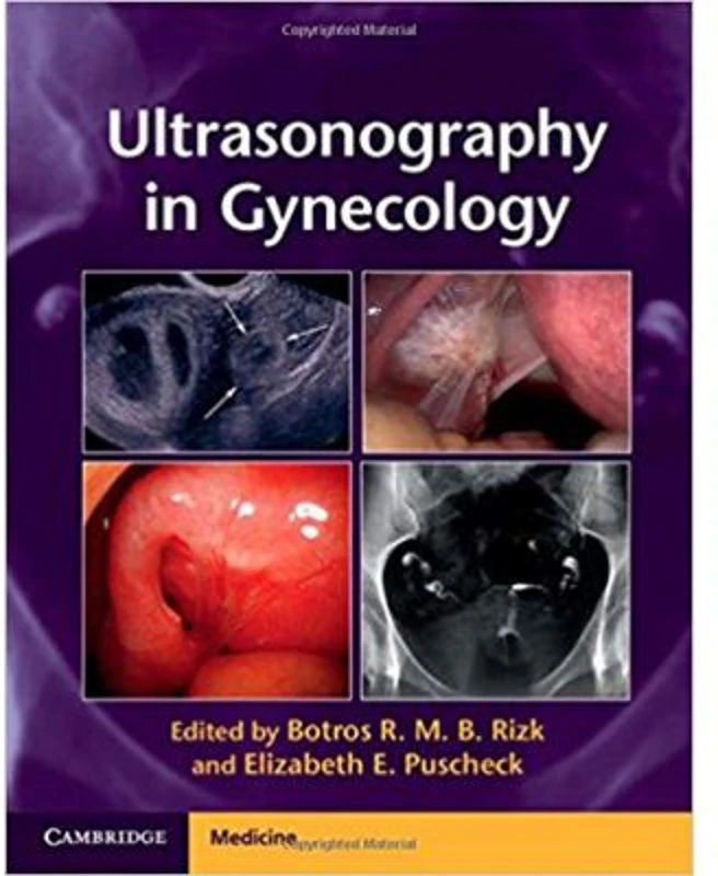 Ultrasonography in Gynecology - Botros R. M. B. Rizk, Elizabeth E. Puscheck
