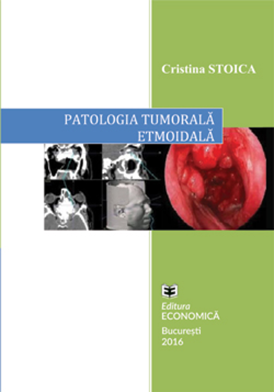 Patologia tumorala etmoidala. Strategii actuale in diagnostic si tratament - Cristina Stoica
