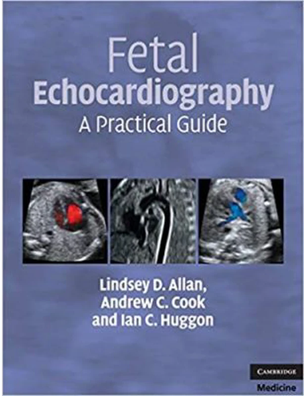 Fetal Echocardiography: A Practical Guide - Lindsey D. Allan, Andrew C. Cook, Ian C. Huggon