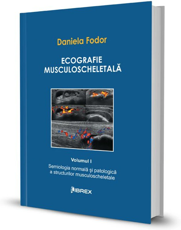 Ecografie musculoscheletală - Daniela Fodor - Vol. I
