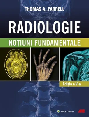 Radiologie - Paperback brosat - Thomas A. Farrell - All