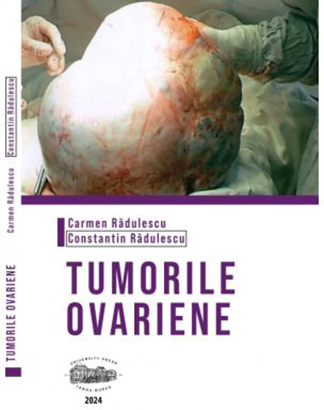 Tumorile ovariene (alb-negru) - Carmen Radulescu
