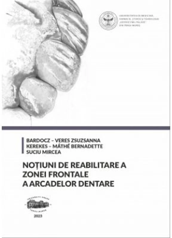 Notiuni de reabilitare a zonei frontale a arcadelor dentare - Bardocz-Veres Zsuzsanna