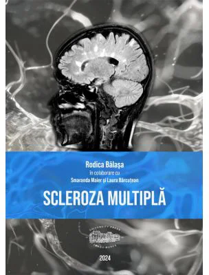 Scleroza multipla (print color) - Rodica Balasa