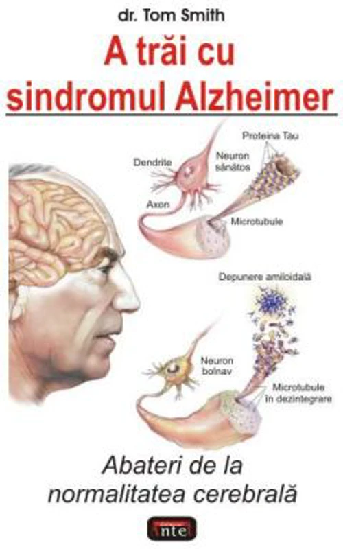 A trai cu sindromul Alzheimer - Tom Smith