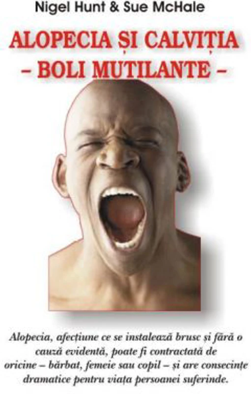 Alopecia si calvitia, boli mutilante - Nigel Hunt