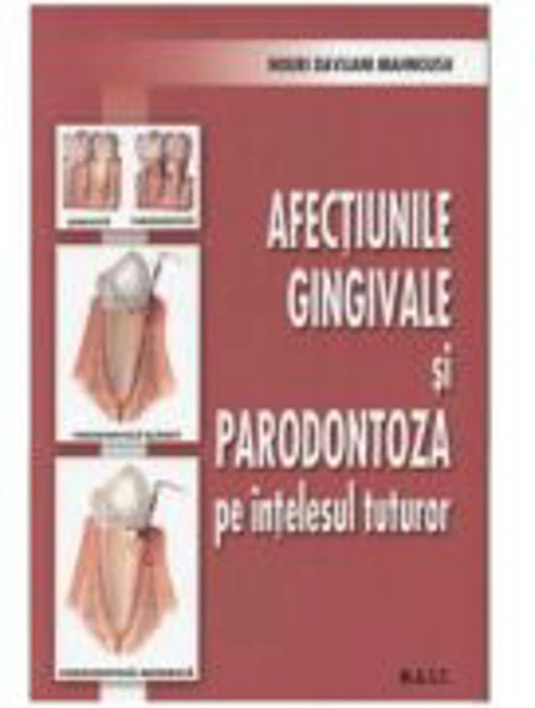 Afectiunile gingivale si paradontoza pe intelesul tuturor - Nouri Davijani Mahnoush