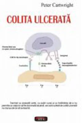 Colita ulcerata - Peter Cartwright