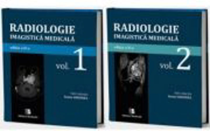 Radiologie-Imagistica medicala. Volumele 1-2 - Ioana-Andreea Gheonea