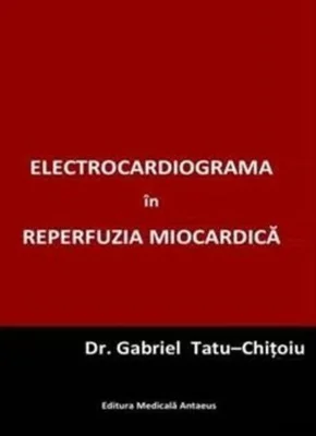 Electrocardiograma în reperfuzia miocardică