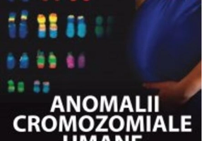 Anomalii cromozomiale umane. Aspecte genetice în diagnosticul prenatal