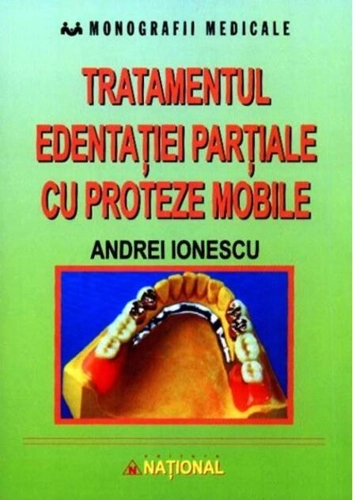 Tratamentul edentației parțiale cu proteze mobile