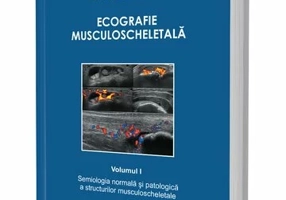 Ecografie musculoscheletală - Daniela Fodor - Vol. I