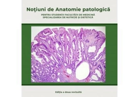 Notiuni de anatomie patologica pentru studentii Facultatii de medicina, specializarea nutritie si dietetica. Editia 2 - Simona Gurzu