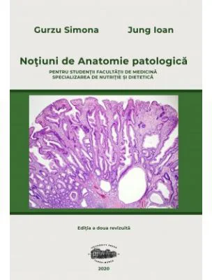 Notiuni de anatomie patologica pentru studentii Facultatii de medicina, specializarea nutritie si dietetica. Editia 2 - Simona Gurzu