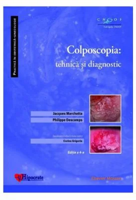 Colposcopia. Tehnica si diagnostic - Jacques Marchetta, Philippe Descamps, Corina Grigoriu