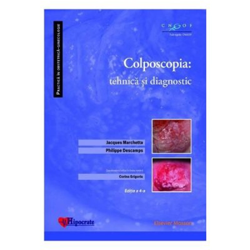 Colposcopia. Tehnica si diagnostic - Jacques Marchetta, Philippe Descamps, Corina Grigoriu