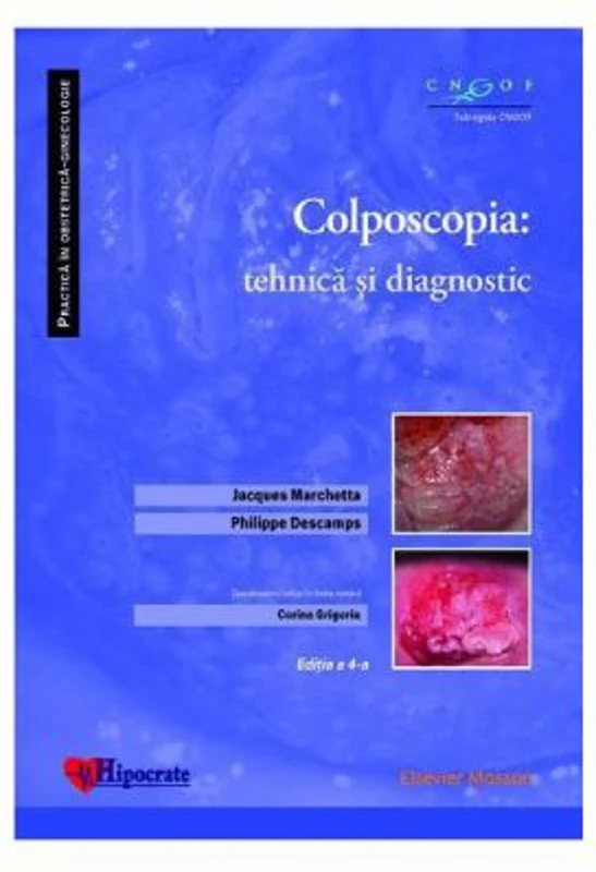 Colposcopia. Tehnica si diagnostic - Jacques Marchetta, Philippe Descamps, Corina Grigoriu