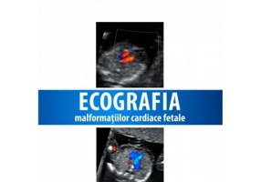 Ecografia Malformatiilor Cardiace Fetale. Brosura + DVD - Claudiu Marginean