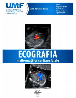 Ecografia Malformatiilor Cardiace Fetale. Brosura + DVD - Claudiu Marginean