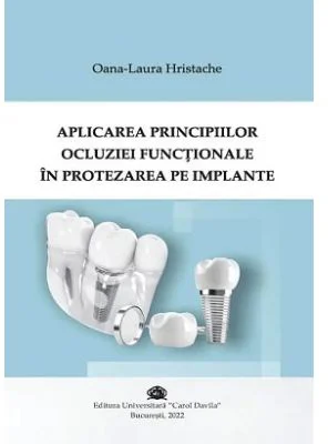 Aplicarea principiilor ocluziei functonale in protezarea pe implante - Oana-Laura Hristache