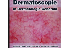 Dermatoscopie in Dermatologia Generala - Aimilios Lallas, Enzo Errichetti, Dimitrios Ioannides, Calin Giurcaneanu, Maria Magdalena Constantin, Alin Co