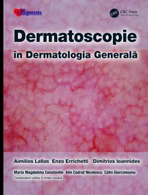 Dermatoscopie in Dermatologia Generala - Aimilios Lallas, Enzo Errichetti, Dimitrios Ioannides, Calin Giurcaneanu, Maria Magdalena Constantin, Alin Co