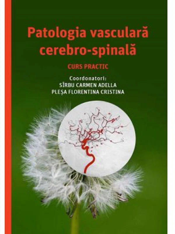 Patologia vasculara cerebro-spinala, curs practic - Carmen-Adella Sirbu, Florentina Cristina Plesa
