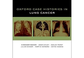 Oxford Case Histories in Lung Cancer - Himender K. Makker, Adam Ainley, Sanjay Popat, Julian Singer, Martin Hayward, Antke Hagena
