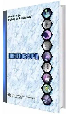 Ureteroscopia - Petrisor Geavlete
