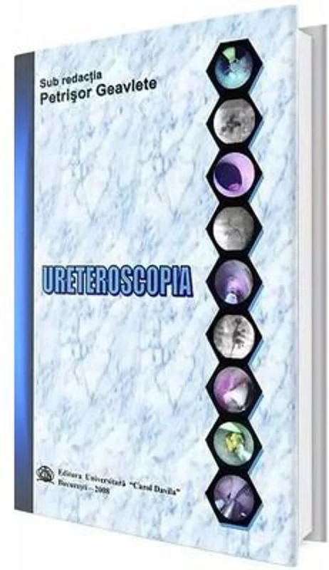 Ureteroscopia - Petrisor Geavlete