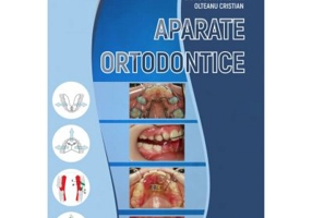 Aparate ortodontice. Color - Silvia Izabella Pop