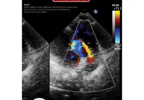 Urgentele cardiovasculare neonatale + DVD - Rodica Toganel
