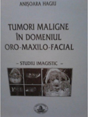 Tumori maligne in domeniul oro-maxilo-facial - Anisoara Hagiu