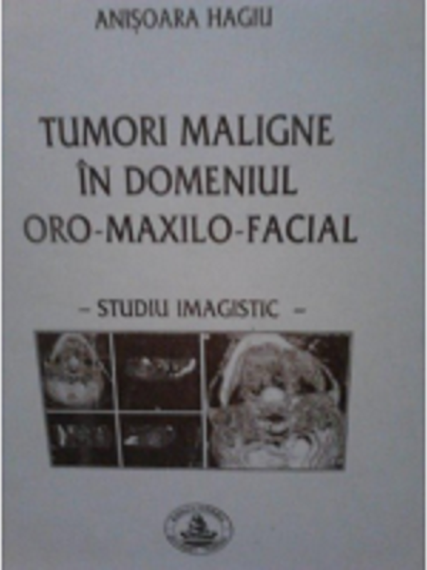 Tumori maligne in domeniul oro-maxilo-facial - Anisoara Hagiu