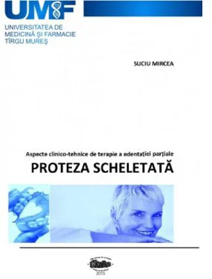 Proteza scheletata - Mircea Suciu