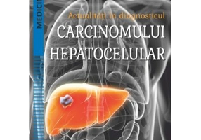 Actualitati in diagnosticul carcinomului hepatocelular - Marilena Stoian