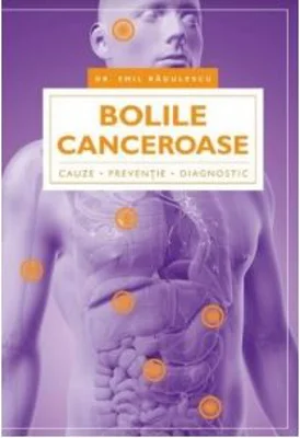 Bolile canceroase. Cauze, preventie, diagnostic - Emil Radulescu