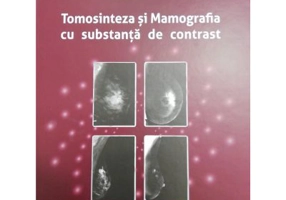 Tomosinteza si Mamografia cu substanta de contrast - Anca Ciurea, Cristiana Ciortea