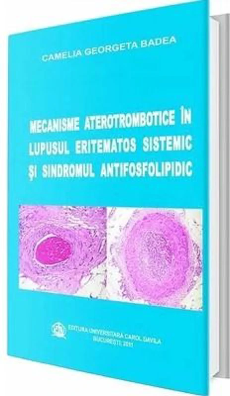 Mecanisme aterotrombotice in lupusul eritematos sistemic si sindromul antifosfolipidic